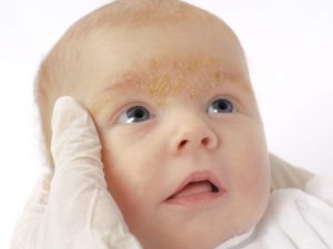 bouton rouge et jaune visage bébé