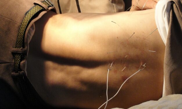 Quelles mesures de prévention sont nécessaires pour une utilisation sûre et efficace de l’acupuncture ?